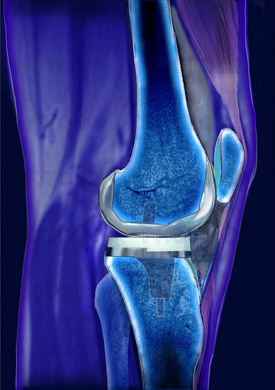 Knee joint