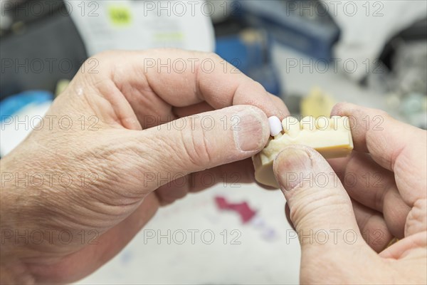 Male dental technician working on A 3D printed mold for tooth implants in the lab