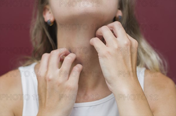 Great concept of allergy and skin diseases, young woman scratching herself