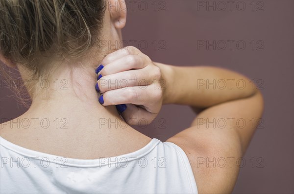 Great concept of allergy and skin diseases, young woman scratching herself