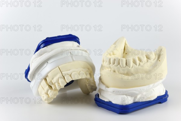 Two dental plaster casts with a blue border on a white background, representing the upper and lower row of teeth, impression for the fabrication of a partial crown