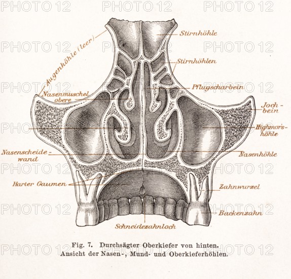 Medicine, anatomy, illustration, drawing, detailed representation of the sawed-through upper jaw and the nasal cavities, oral cavity and maxillary sinuses, with captions, hard palate, nasal septum, upper nasal concha, eye socket, frontal sinus, ploughshare bone, zygomatic bone, Highmor's sinus, nasal cavity, tooth root, molar tooth, historical illustration in black and white from Meyers encyclopedia 4th edition 1889 and 1890, Germany, Europe