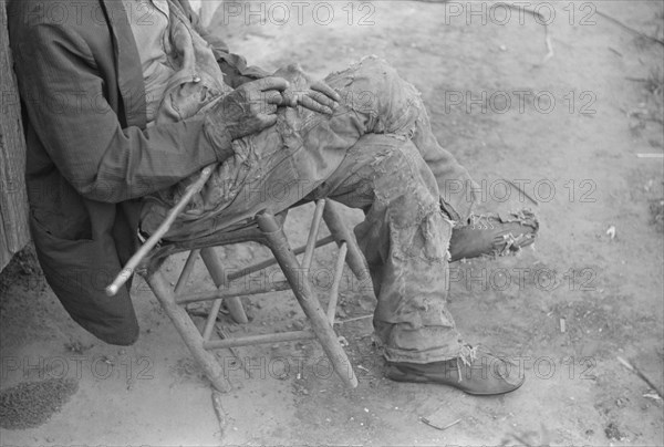 Elderly Man with Missing Fingers, Camden, Alabama, USA, Marion Post Wolcott for Farm Security Administration, May 1939