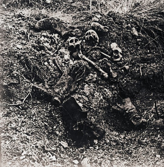 Human remains, c1914-c1918. Artist: Unknown.