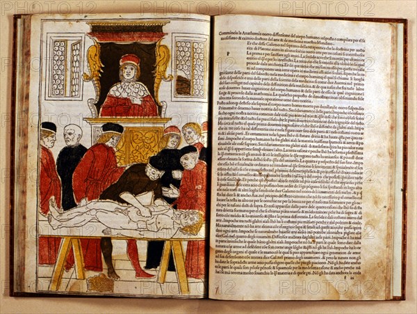 Coloured xilograph that shows for the first time the operation of a corpse dissection, 1493-1494. Creator: Johan Ketham (1415-1470).