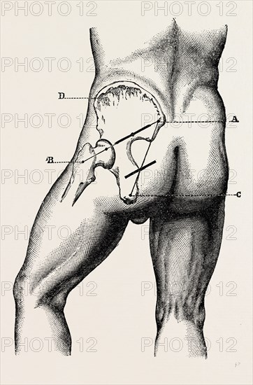 the incisions, medical equipment, surgical instrument, history of medicine