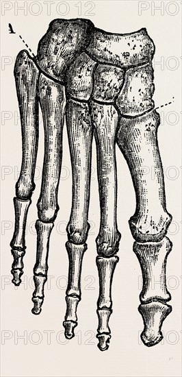 bones, medical equipment, surgical instrument, history of medicine