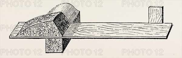 lister' s splint for excision, medical equipment, surgical instrument, history of medicine