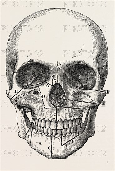 incisions, medical equipment, surgical instrument, history of medicine