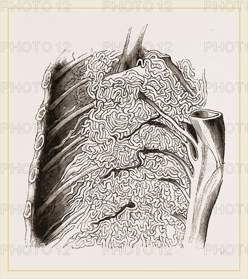 Vascular Apparatus of Whale