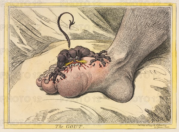 The Gout, 1799. James Gillray (British, 1757-1815), Hannah Humphrey. Etching hand-colored with watercolor ; sheet: 32.3 x 46.5 cm (12 11/16 x 18 5/16 in.); platemark: 26 x 36.5 cm (10 1/4 x 14 3/8 in.)