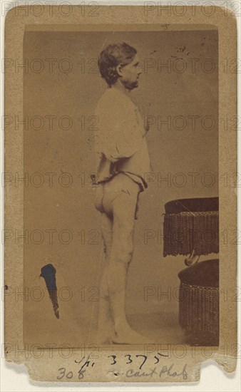 Hugh Wright Civil War victim; Attributed to William H. Bell, American, 1830 - 1910, about 1865; Albumen silver print