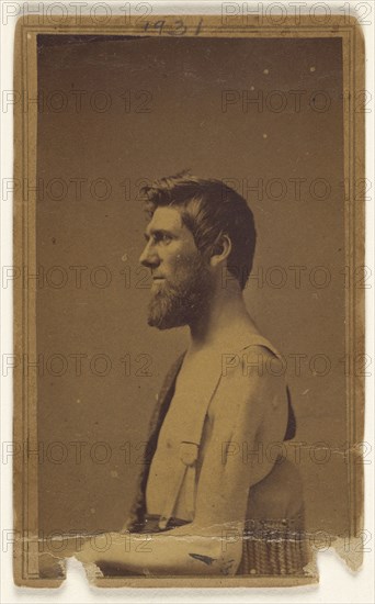 Civil War victim in profile, seated; Attributed to William H. Bell ...