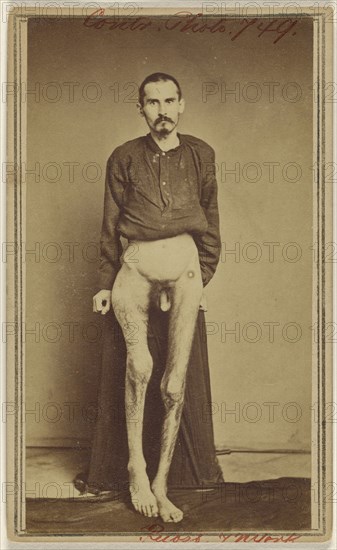 Geo. Ruass. Civil War victim; Attributed to William H. Bell, American, 1830 - 1910, 1862 - 1864; Albumen silver print