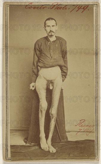 Geo. Ruass Civil War victim; Attributed to William H. Bell, American, 1830 - 1910, about 1864; Albumen silver print