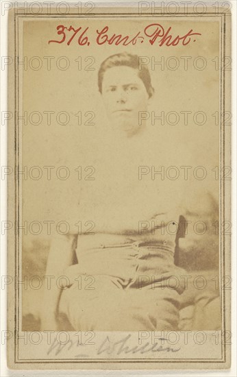 Wm. Whitten Civil War victim; Attributed to William H. Bell, American, 1830 - 1910, 1865 - 1867; Albumen silver print