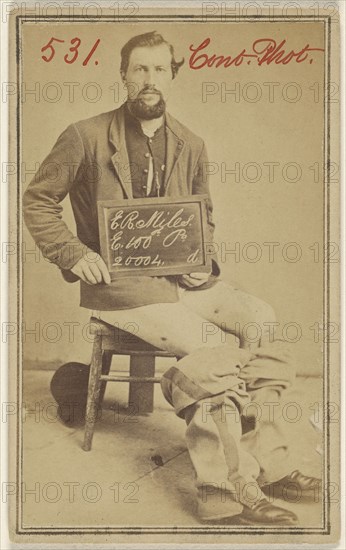 E.R. Niles, E. 100th Pa. 20004. Civil War victim; American; 1862 - 1864; Albumen silver print