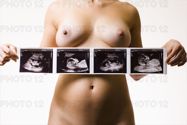 Studio shot of naked pregnant woman holding ultrasonography picture. Photo : Noah Clayton
