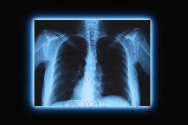 Studio shot of chest x-ray.