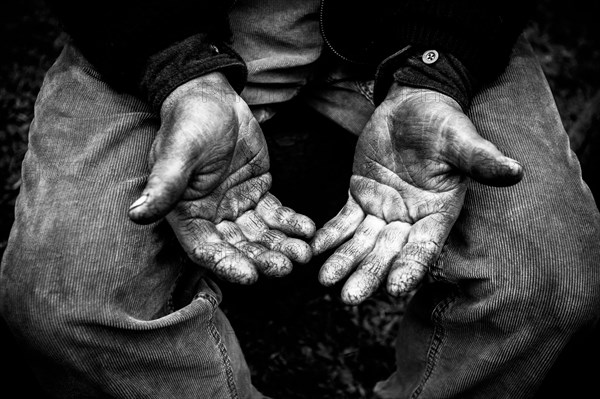 Farmer showing rough hands