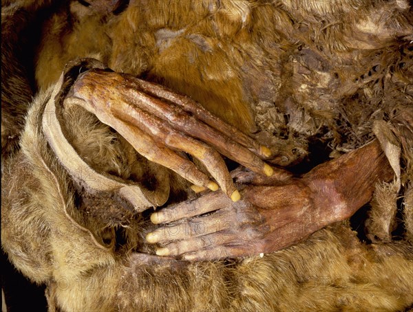 Greenlandic child, preserved through natural mummification