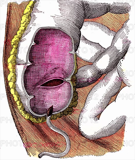 Digestive tract, the caecum or cecum and the appendix ileo cecal. book by dr jules rengade ' life and health ' ,paris 1881