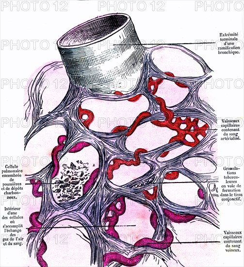 Venous blood in arterial blood transformation in the lungs cell. above: end of a bronchial branching. book by dr jules rengade ' life and health' paris, 1881