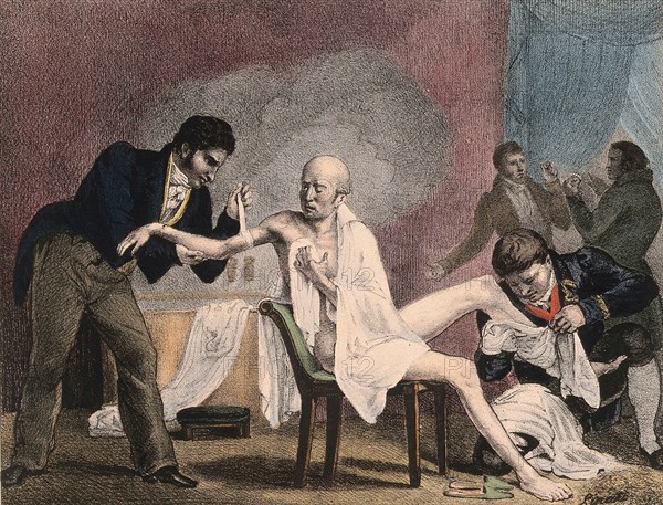 An emaciated old man being treated by four doctors, 1852, a steam bath billows in the background. The two men on the far right hold a glass eye and a pair of false teeth, France, Historic, digitally restored reproduction of an original of the time..