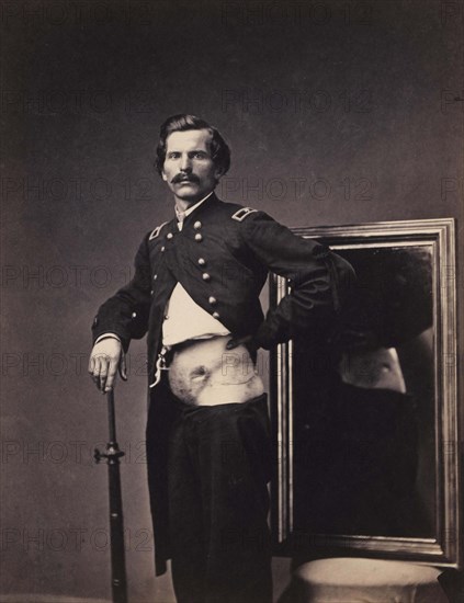 War wounded, Major H. A. Barnum, recovering from a penetrating abdominal gunshot wound with perforation of the left ilium, from the Surgical Department Photographic Catalogue, 1880, photograph by William Bell, Historic, digitally restored reproduction from an original of the period.