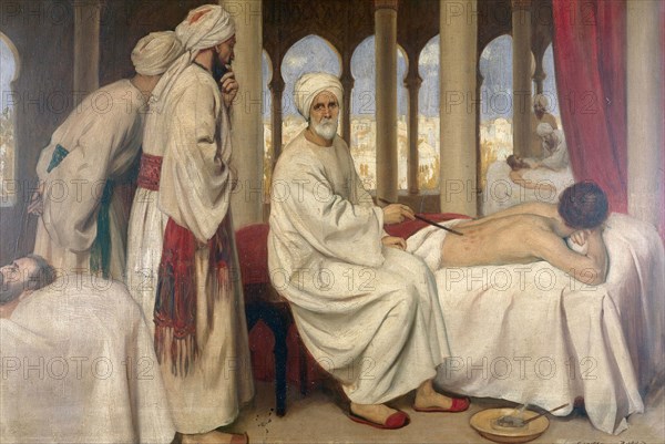 Albucasis caring for a patient in Cordova Hospital. Oil painting by Ernest Board. Albucasis (Abul-Qasim Khalaf ibn Abbas al-Zahrawi) was born in the tenth century near Cordova and died around 1013 A.D. His treatise on surgery is most notable for its descr